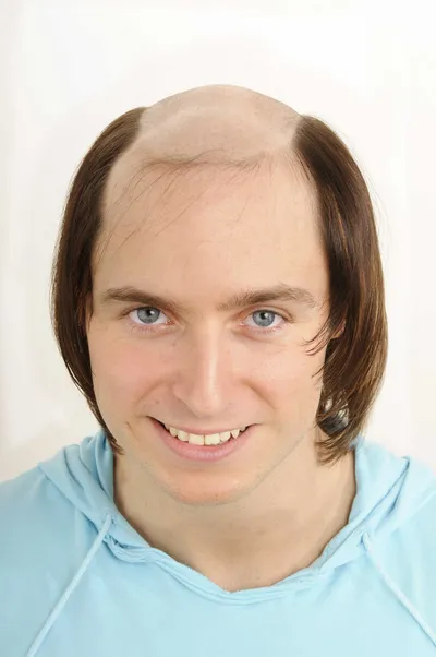 Vorher
