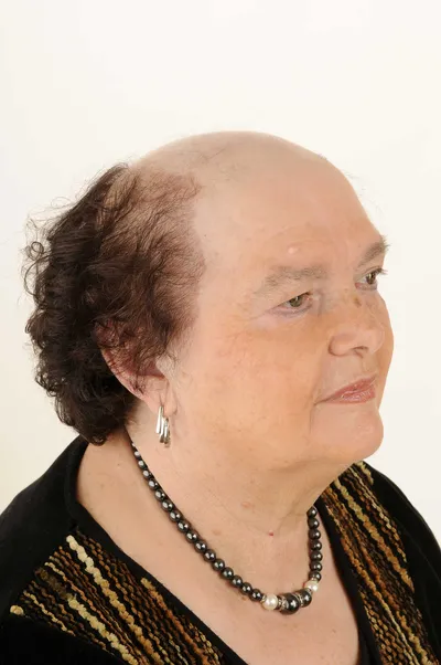 Vorher