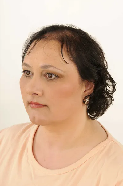 Vorher