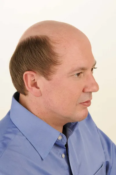 Vorher